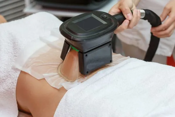 Image of person having fat freezing treatment to help weight gain Wibsey