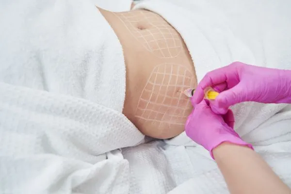 image of fat dissolving injections on love handles to help combat weight gain Wibsey