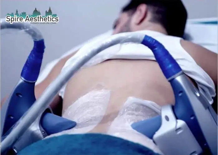 Man having fat freezing treatment done on love handles before a competitions Wibsey to create a sculpted look.