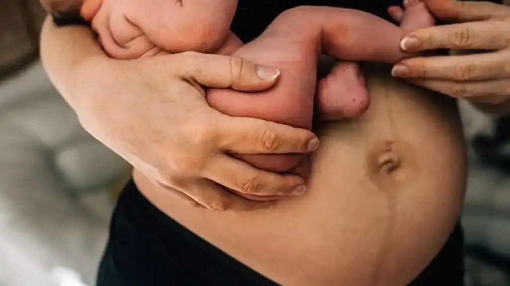 Why Is My Stomach Still Big After Pregnancy Wibsey?